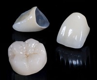 protesi-denti-corona-2